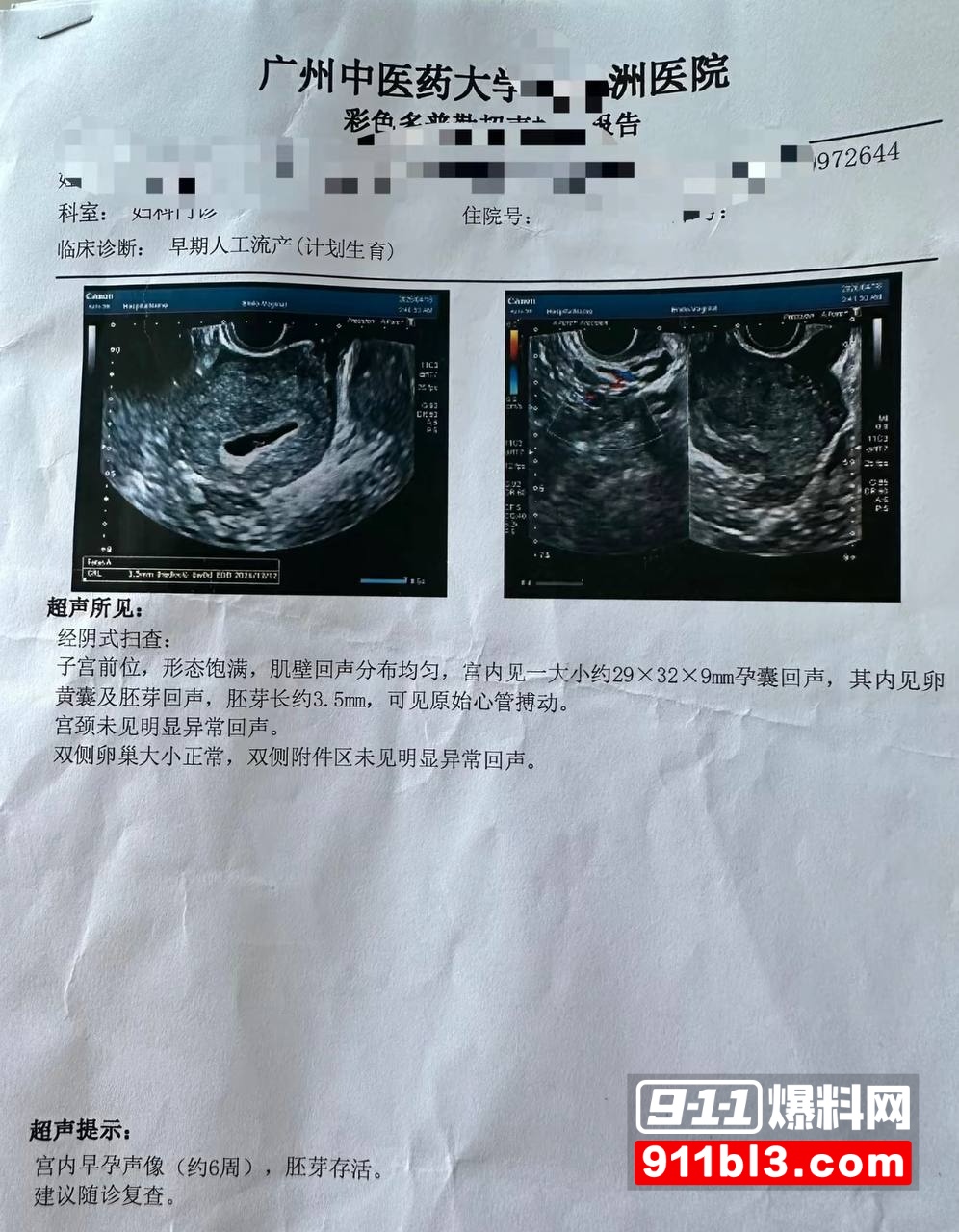 700万粉网红贵阳二小姐知三当三1