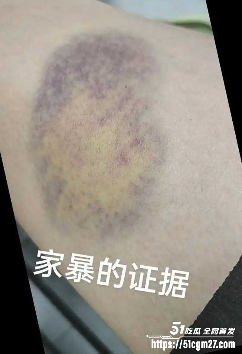 前国脚孙吉被实名举报骗婚家暴事件 22 拷贝