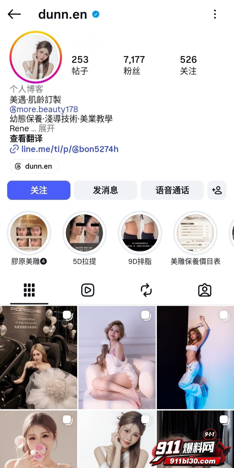 小网美dunn.eng与前男友露脸自拍做爱视频曝光5