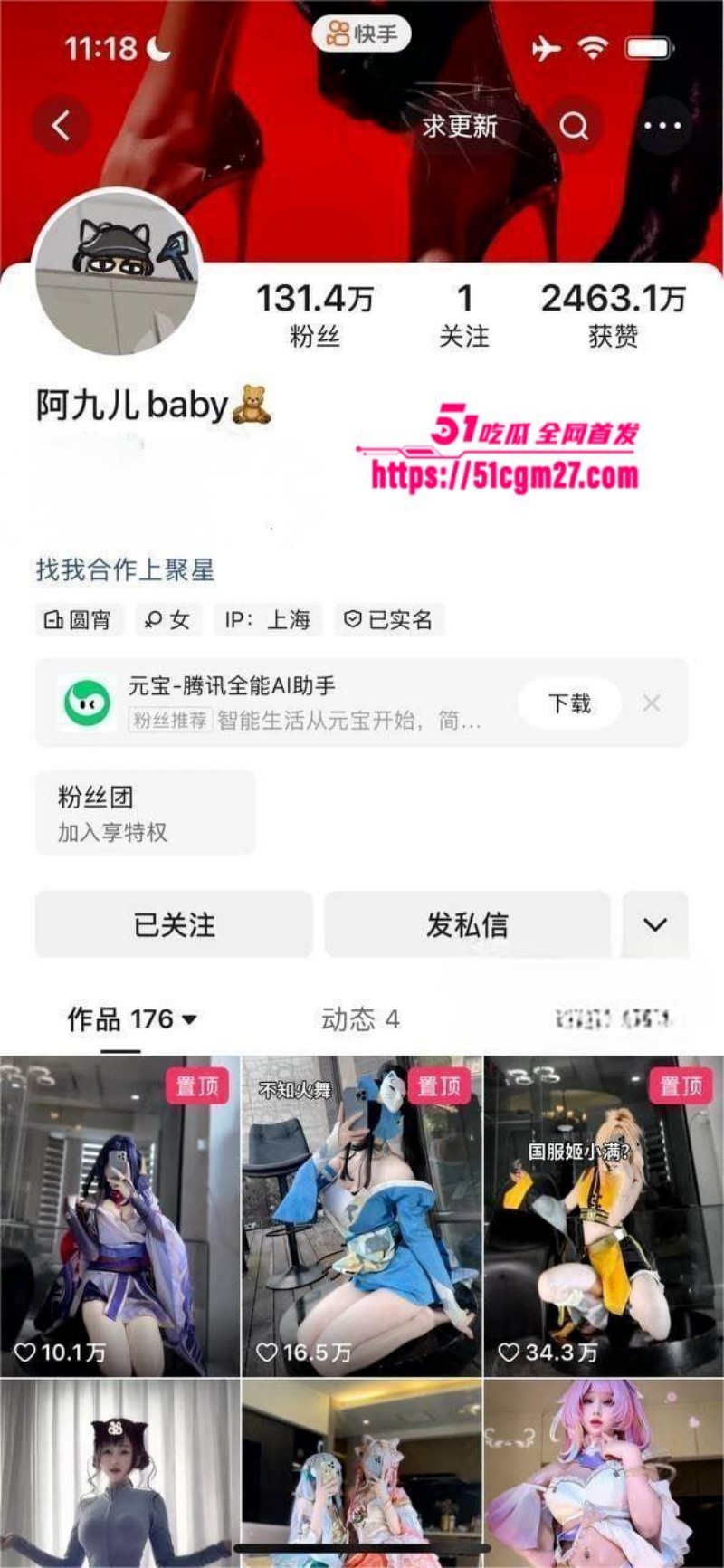 抖音网红 阿九儿baby 定制福利 1